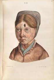 The Sick Rose Disease And The Art Of Medical Illustration Beautiful And Shocking Vintage Medical Drawings In Pictures Medical Drawings Medical Illustration Vintage Medical