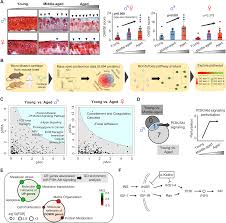 Age-related matrix stiffening epigenetically regulates α-Klotho expression  and compromises chondrocyte integrity | Nature Communications