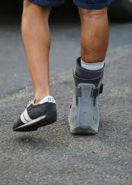 It connects muscle to bone. Achilles Tendon Rupture Orthopaedic Associates Of Central Maryland