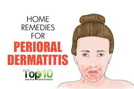 Home Remedies For Perioral Dermatitis Red Bumps Around The Mouth Top 10 Home Remedies Perioral Dermatitis Perioral Skin Care Remedies