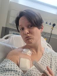 Diagnosed with invasive lobular carcinoma in November of last year. Had  lumpectomy Feb 10. First chemo treatment may 12. Starting to lose my hair.  Have 3 more treatments. Each 3 weeks apart.