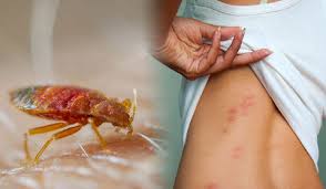 In many cases, a mouse trap or a can of bug spray won't do the trick when you want to get rid of pests in the frequency of service also will determine the price you pay for pest control service. Bed Bugs Control Bristol Extermination Aman Pest Control