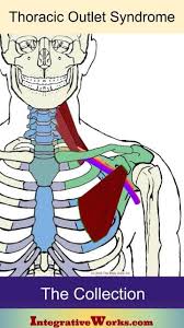 Pin On Thoracic Outlet
