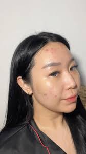 losing face fat was one of the best result from my hard works.⁣, ⁣, i lost  17kgs in a year (2kgs muscle mass, 15kgs fat mass), 5 months to be exact  sisanya trying to hold