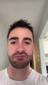 Modified Robert Jones Bandage