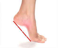 Check spelling or type a new query. How Do I Know If I Have Flat Feet