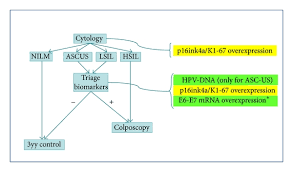 Diagnostics of cervical cancer | latest medical news about the newest treatment methods in germany. Viral And Cellular Biomarkers In The Diagnosis Of Cervical Intraepithelial Neoplasia And Cancer