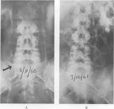 Image result for Methysergide