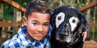 Bruno lima (são paulo, 25 de agosto de 1986) é um delegado de polícia e político brasileiro filiado ao partido social liberal (psl). Garotinho Com Vitiligo Se Emociona Ao Encontrar Cachorro Com A Mesma Condicao Genetica Delegado Bruno Lima