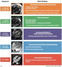 Image result for Pericarditis