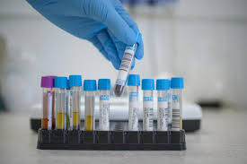 See full list on transmedexpert.ro Analize Medicale ProvidenÈa PoliclinicÄ Èi Spital