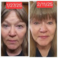 Personal experience with F59, F06, F82, and F07 anti-aging cream products