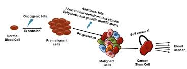 Image result for Hematologic Cancer