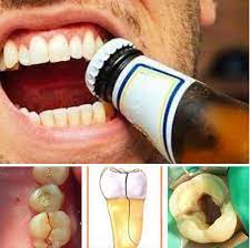 Chateau of Smiles Dental Clinic - FYI! Your teeth are not tools!‼️ ?✂️❌ Avoid the habit of biting things and using them to open hard objects. You will lose then before you