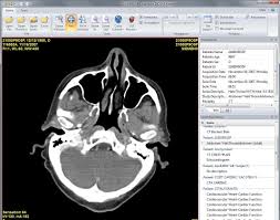 Emv can access wado pacs systems to retrieve studies. Jivex Dicom Viewer Light Banksskiey