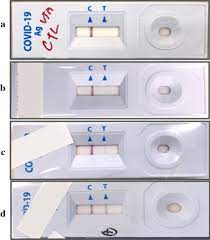 Interpretation Of Rapid Sars Cov 2 Antigen Detection Assay Standard Q Download Scientific Diagram