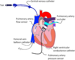 Image result for Afterload