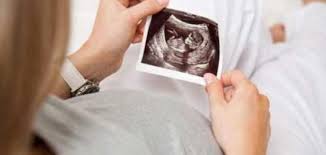 حركة الجنين في الشهر الرابع في اليسار وأسباب تأخر حركة الجنين زيادة