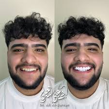 د.علي السرحان Dr.Ali Al Sarhan‎ (@dr.ali.alsarhan) • Instagram photos and  videos