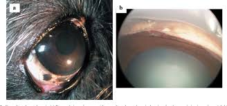 Image result for melanosis sclera