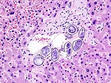 Ich komme gerade gar nicht mehr klar. Pathologie Druckversion Wikibooks Sammlung Freier Lehr Sach Und Fachbucher
