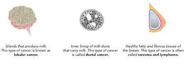 This is one of the reasons why there continue to be many deaths from this disease. 7 Warning Signs Of Breast Cancer In Indian Women 2021 Updated