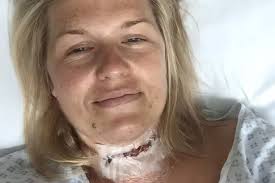 Four-year-old girl's heartwarming act as cancer mum returns home after  life-saving surgery with massive scar across neck