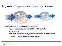 Gaucher Disease Physiopedia