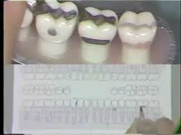 Dental Charting Procedures