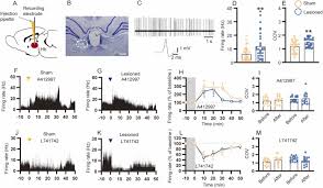 Dopamine D4 receptors in the lateral habenula regulate anxiety-related  behaviors in a rat model of Parkinson's disease