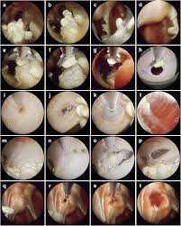 Neuroendoscopic training in neurosurgery: a simple and feasible model for  neurosurgical education