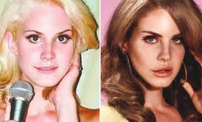 Lana del rey, whose real name is elizabeth woolridge grant,. Lana Del Rey Plastic Surgery Lip Filler Nose Job Breast Implants
