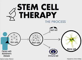 Master Cells May Hold Key To Longevity Disease Prevention Local Institute Finds Redwood Bark
