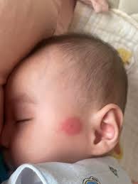 被咬的红包- 抖音