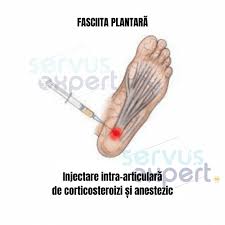 Fasciita Plantară Durere De Talpă și Călcai Cauze și Soluții In 2020 Fitness Peace Gesture Peace