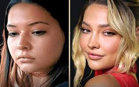 Madelyn Cline Plastic Surgery Transformation: Before and After