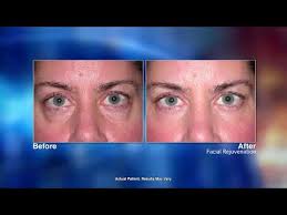 Timothy M. Greco, MD, FACS