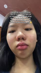 Đánh giá sản phẩm skincare: Toner Diếp Cá và Serum