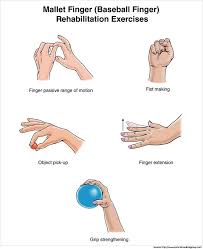 Urban Wired Physical Therapy Exercises Hand Therapy Finger Exercises