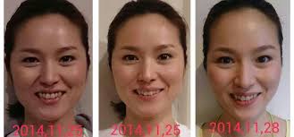 顔を鍛えて人生が変わったカラクリ 美容整形 フェイスケア シワ たるみ