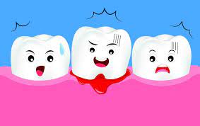 Minor To Moderate Bleeding After A Wisdom Tooth Extraction Dental Implants Or Dental Surgery Is Normal Tooth Extraction Wisdom Tooth Extraction Wisdom Teeth