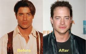 Brendan fraser is an icon. Celebrities Who Have Aged The Worst Brendan Fraser Young Celebrities Worst Celebrities