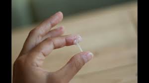 After your period ends, you'll have a dry spell, literally; Pictures And Videos Of Cervical Mucus Ovulation Discharge Cervical Fluid Groove