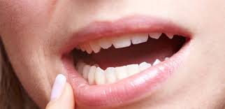 Additionally, he might need to break the tooth into several pieces in order to remove it from the jaw. Wisdom Teeth Wollaton Dental Care