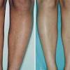 Personal preferences, a holiday coming up, aesthetic, there are many reasons why you'd want to be rid of your pubic hair. 1