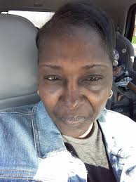 Mouse Juice Loading.... 3 weeks ago I learned that I was in an ugly flare  and had numerous new granulomas in my lungs. My Rhemy started working with  insurance to increase Remicade.