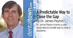 A Predictable Way to Close the Gap by Dr. James Peyton