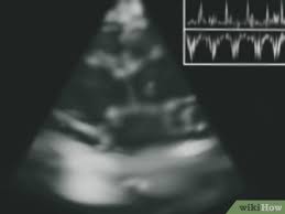 It does not matter which one they select, and it is possible to pass the exam without examining where it might. 3 Ways To Determine Cardiac Output Wikihow