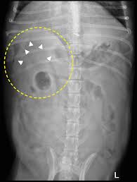 Benign pancreatic tumors in domestic and laboratory animals are rare, although pancreatic adenomas in dogs and cats do occur. The Role Of Imaging In Diagnosing Pancreatitis Mspca Angell