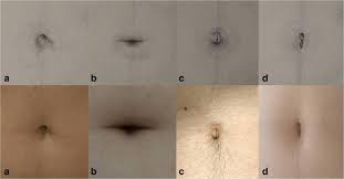 Image result for Umbilicus